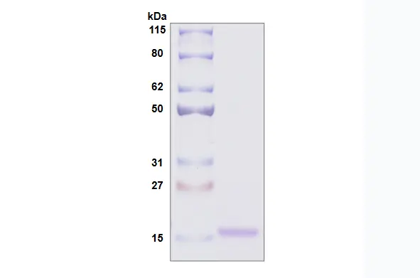 [MC06-025] Recombinant Human Galectin 10, His Tag -25 ug
